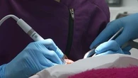 Près de 2,3 millions d'euros : 4 dentistes soupçonnés d'avoir réalisé des soins inutiles sur des patients