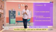 Le doc vous conseille : Surveiller sa peau, c’est quoi la méthode ABCDE ?