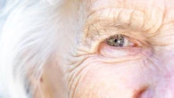 Une micro-puce pourrait rendre la vue aux personnes âgées souffrant de DMLA