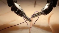Un robot chirurgien dopé à l'IA réalise la première opération complexe sans intervention humaine