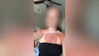 "On s'expose à un risque de cancer mortel à l'âge adulte" : les alertes se multiplient face à la mode du coup de soleil volontaire