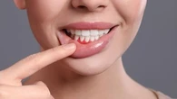 Santé bucale : n'oubliez pas de prendre soin de vos gencives !