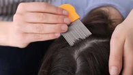 Traitements anti-poux : pourquoi il ne faut jamais utiliser des produits pour animaux sur les enfants