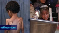 VÉRIF' - Oui, ces photos d'enfants gazaouis affamés sont bien réelles