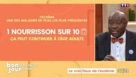 Ça ira mieux demain : Le vrai/faux de l'eczéma