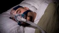 "80% des patients ne le savent pas" : les conseils d'un médecin pour diagnostiquer le syndrome de l'apnée du sommeil