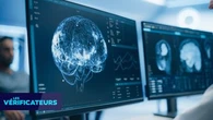 Ces rumeurs qui ont la vie dure : "On n'utilise que 10% de notre cerveau"