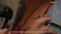 Contrôle des grains de beauté en pharmacie : quelle efficacité ?