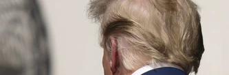 Le traitement contre la calvitie de Donald Trump inquiète plusieurs médecins, sa capacité à gouverner en question