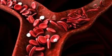 Este análisis de sangre detecta el riesgo de depresión y de trastorno bipolar