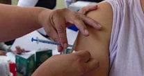 Brote de sarampión suma casi 3 mil casos en México; Chihuahua concentra más del 95%