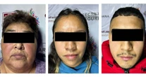 La SSC captura a 3 en la Alcaldía Miguel Hidalgo; les aseguran 786 dosis de droga