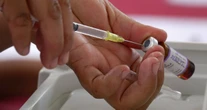 La SSa emite alerta de viaje por aumento de casos de sarampión en EU y Canadá