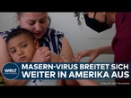MASERN-AUSBRUCH: Hunderte Kinder infiziert! Virus breitet sich von Nordamerika nach Mexiko aus