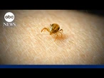What to know about meat allergies caused by tick bites