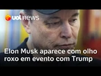 Musk aparece com olho roxo em evento com Trump: 'Vai e me dá um soco'