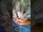 Roboter-Chirurgie setzt neuen Standard bei Herzklappen #shorts