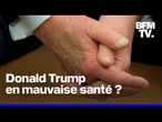 Pourquoi l’apparition de Donald Trump ne suffit pas à calmer les rumeurs sur son état de santé