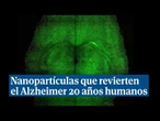 Consiguen revertir el Alzheimer el equivalente a 20 años humanos usando nanopartículas