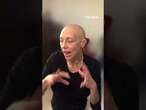 Woman living with alopecia reacts to 4B movement