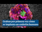Graban por primera vez cómo un se implanta un embrión humano y sorprende su "fuerza considerable"