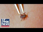 Rare tick-borne virus SURGES as summer camp season begins