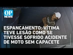 Vítima de agressão no elevador teve lesão semelhante a acidente de moto sem capacete| O POVO News