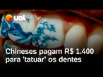 Chineses pagam R$ 1.400 para 'tatuar' os dentes; dano pode ser permanente?