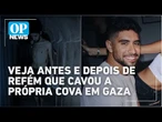Evyatar David: veja antes e depois do refém israelense gravado cavando a própria cova | O POVO News