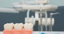 Dofinansowanie na dentystę. Niewielu wie, że przyznają po 600 zł