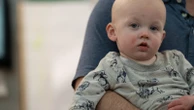 Too young for the MMR shot, babies become 'sitting ducks' in measles outbreaks