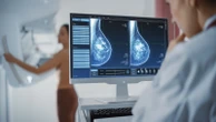 New guidance drops breast cancer screening age to 40 for women with average risk Prior USPSTF recommendations said women should start screening at age 50.4/30/2024 11:02:00 EDT
