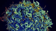 UN says if US funding for HIV programs is not replaced, millions more will die by 2029