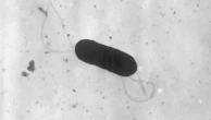 What to know about food poisoning illnesses caused by listeria