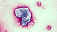 Everything you need to know about symptoms, treatments, vaccines for RSV