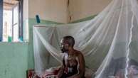 Mpox deaths rise by 107 in a week as Africa CDC calls the toll unacceptable