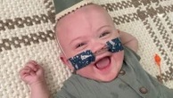 Boy sets Guinness record for world's most premature baby, celebrates 1st birthdayWhen Nash Keen was born, he weighed just 10 ounces.27 minutes ago