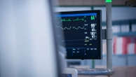 Doctors may need to rethink routine beta blocker use after a heart attack