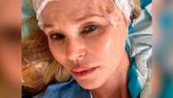 Christie Brinkley reveals she had surgery to remove skin cancerBrinkley said the 