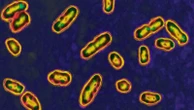 New Mexico man diagnosed with plague in state's 1st human case this year