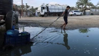 8 die from hunger, including child, in Gaza over past day, health ministry says