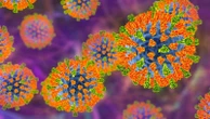 More than 150 people in this state exposed to measles, health officials say