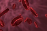 Mengenal Talasemia, Diidap oleh 10.647 Penduduk Indonesia