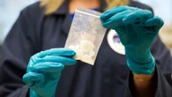 Furto fentanyl, ispezione dei carabinieri all'Israelitico, Pregliasco: "Grave minaccia per salute"