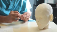 Naso di un bimbo aggredito da un animale ricostruito con stampe 3D. Il video