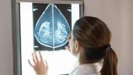 Tumore seno, Schillaci: “Breast unit sono la risposta migliore”. Kyriakides: “Anch'io sopravvissuta"