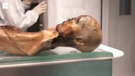 Ötzi, sul corpo e nella flora intestinale trovati lieviti ancora attivi