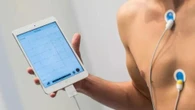 Arresto cardiaco improvviso nei giovani, dna e cicatrici cuore le cause finora ignote 