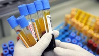 Primo caso di influenza aviaria H5 nell'Australia continentale