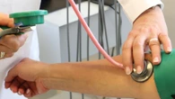 L'ictus non colpisce solo gli anziani, aumentano i casi tra i giovani. Che cos'è il "binge drinking"